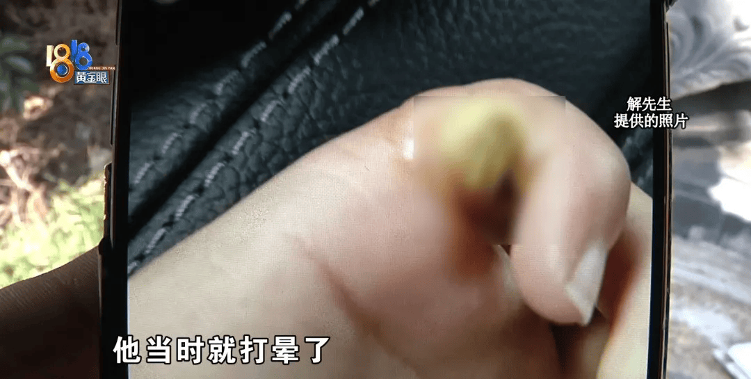 5岁男童瞬间晕厥<strong></p>
<p>融祥贵金属诈骗</strong>，筋都断了！街上常见，看见立即远离