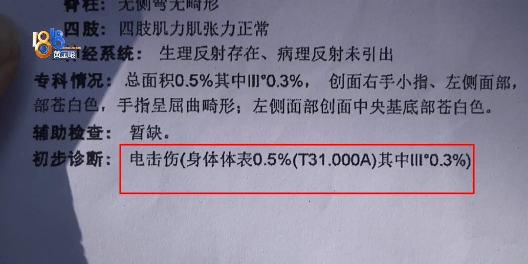 5岁男童瞬间晕厥<strong></p>
<p>融祥贵金属诈骗</strong>，筋都断了！街上常见，看见立即远离