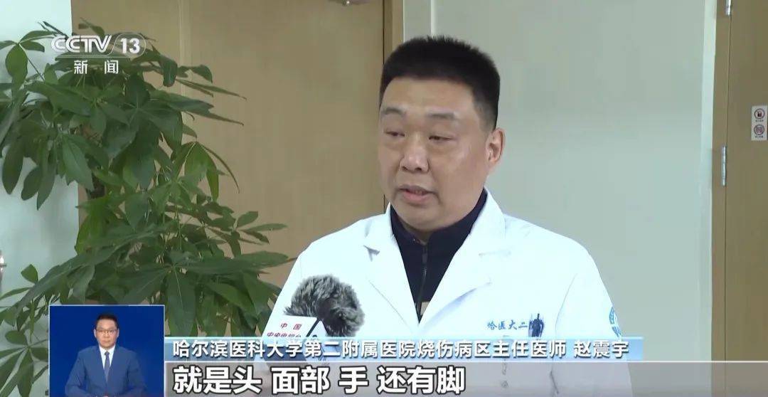 南方游客在哈尔滨“泼水成冰”受伤<strong></p>
<p>网易乐得销售贵金属</strong>！最新提醒