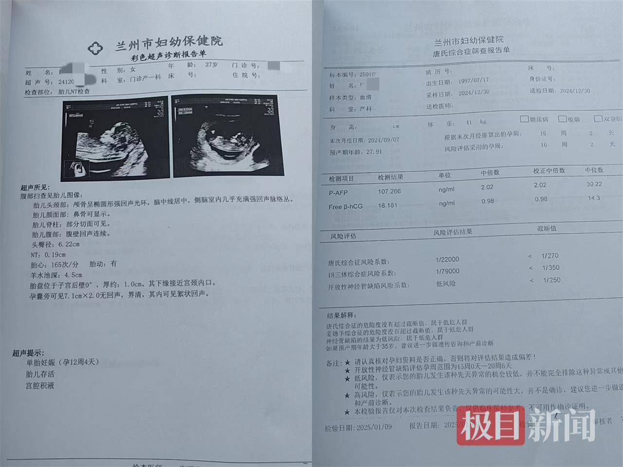二胎出生查出先天性病症或落下残疾<strong></p>
<p>艾达币APP下载</strong>，残疾父母称医院产检漏检、未尽告知义务，医院及医调委回应