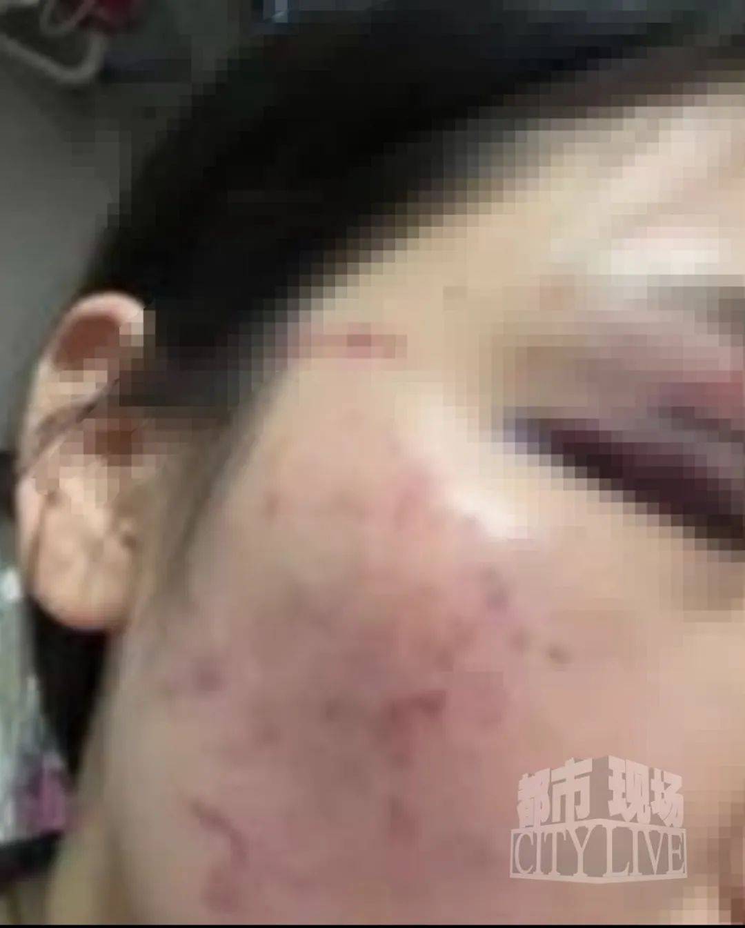 湖南衡阳29岁女子疑被男友施暴后从25楼跳下身亡 男友徐某此前还刺激说：“你放心<strong></p>
<p>比特现金行情</strong>，她不会去死的”