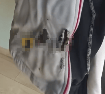 高中生散步时校服突发自燃<strong></p>
<p>DOT价格</strong>？原是165元网购的“宝”在惹祸→