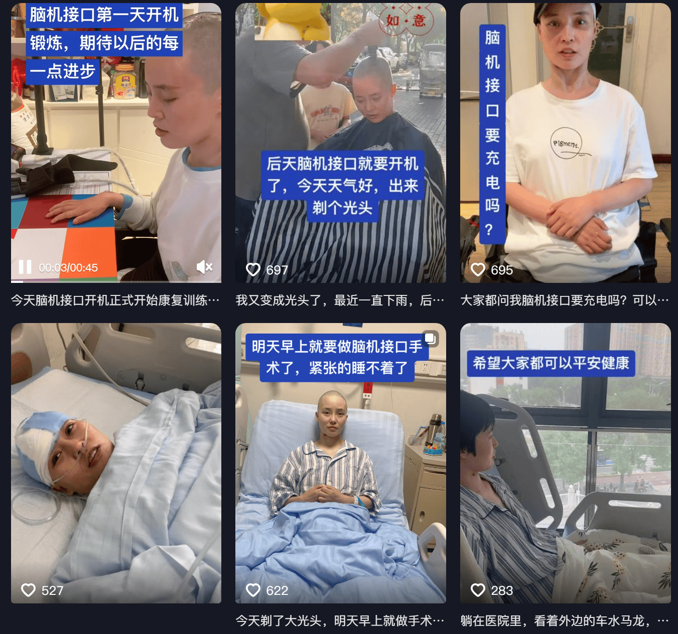女子因车祸全身瘫痪6年仅嘴眼能动<strong></p>
<p>BNB价格</strong>，接受脑机接口手术后通过意念抓取物品！当事人讲述