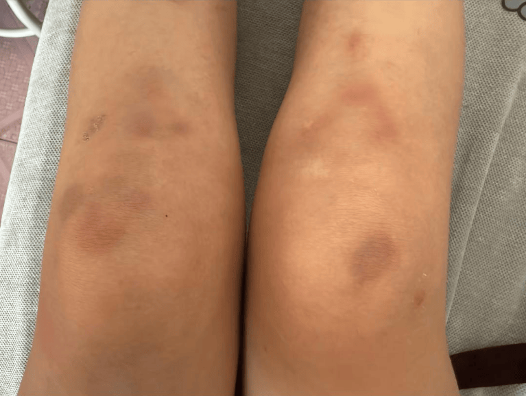 女子自称因工资问题被老板锁办公室里打 警方：双方已到派出所<strong></p>
<p>LTC价格</strong>，是否打人还在调查