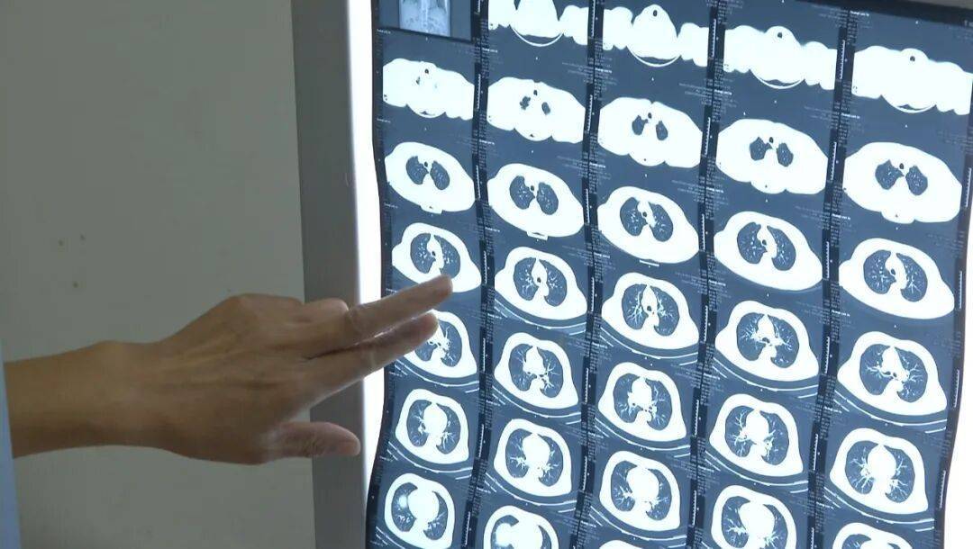 许多患者没有症状<strong></p>
<p>数字货币交易</strong>，发病就猝死！警惕这种心脏疾病