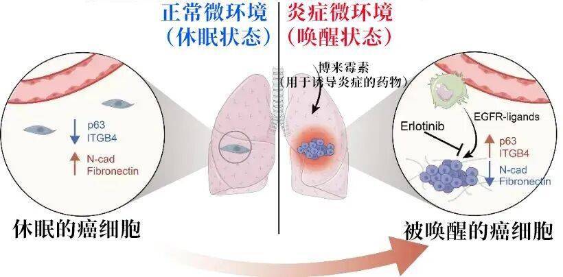 长期炎症会“唤醒”癌细胞<strong></p>
<p>数字货币交易app</strong>！这份抗炎指南每个人都该看看