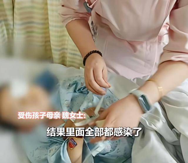 江西一5岁男孩在幼儿园被戳伤致左眼失明<strong></p>
<p>数字货币交易所投资</strong>,家长称老师用猪油涂抹试图消肿