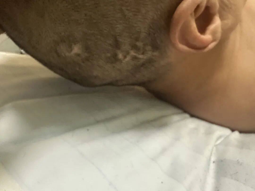 4名游客景区内遭马蜂袭击<strong></p>
<p>数字货币交易APP下载</strong>，旅游度假区：是森林公园不卖门票，蜇伤先就医后提供证据投诉