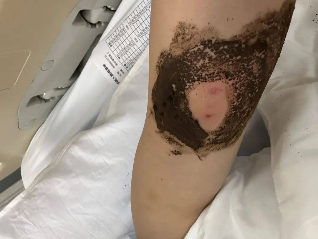 4名游客景区内遭马蜂袭击<strong></p>
<p>数字货币交易APP下载</strong>，旅游度假区：是森林公园不卖门票，蜇伤先就医后提供证据投诉