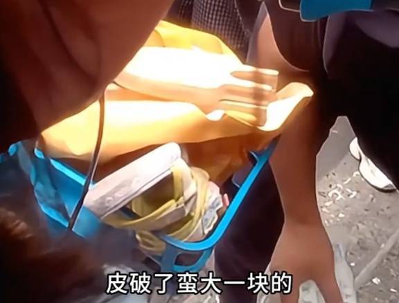 看着都疼<strong></p>
<p>数字货币app</strong>！上海街头一男子突然求助：10岁女儿被死死卡住！这个行为太危险→