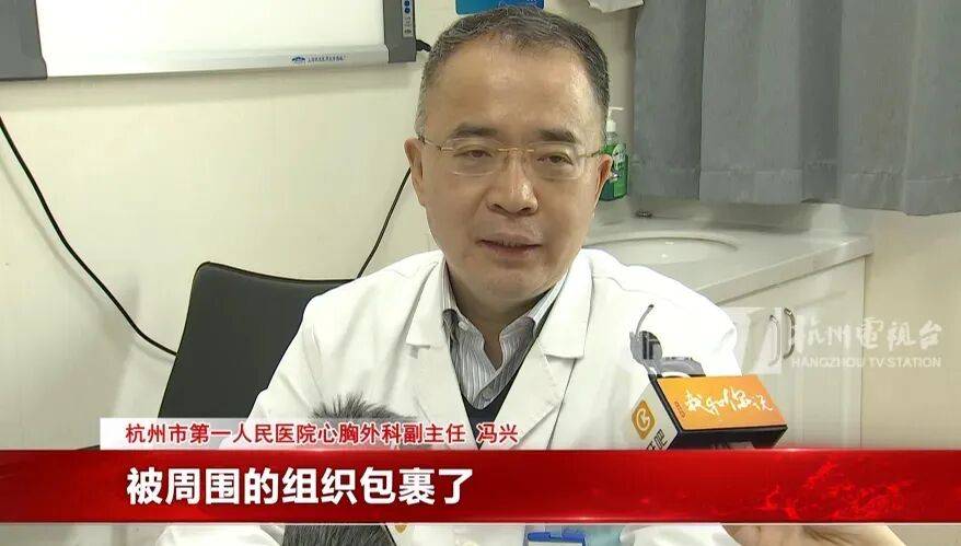 17岁小伙参军体检发现胸腔内有根5cm缝衣针<strong></p>
<p>平安证券交易行情</strong>,父母回忆或是1岁时扎入,取出时已锈迹斑斑